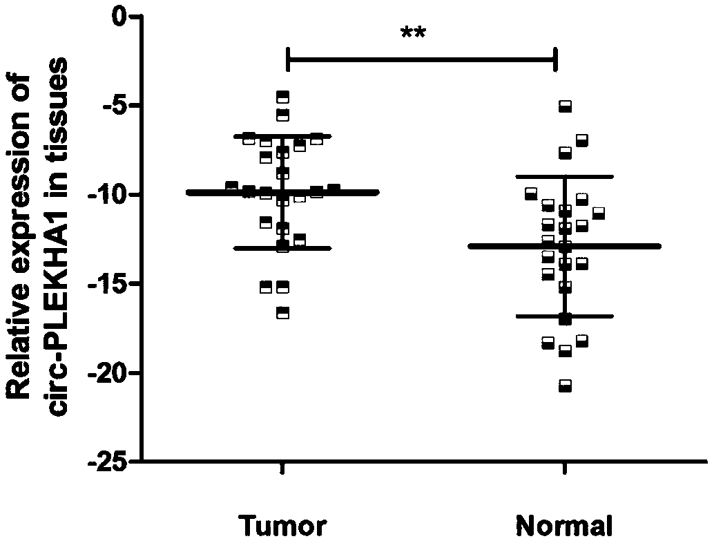 Application of circ-PLEKHA1 molecular marker in blood to diagnosis of ESCC (esophageal squamous carcinoma)