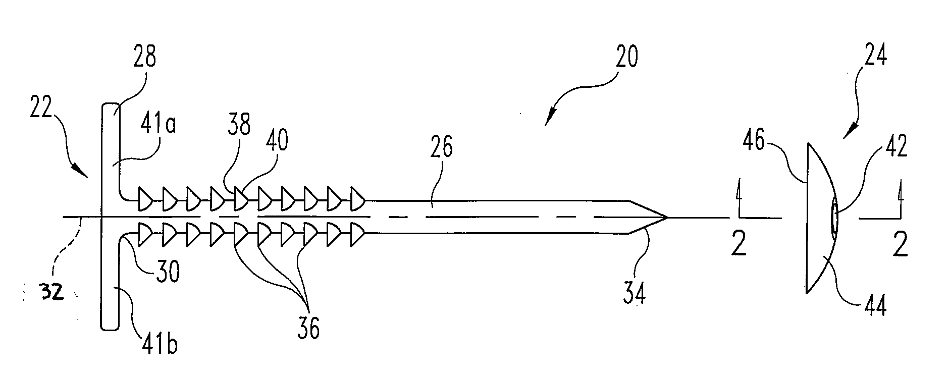 Soft tissue reattachment mechanism