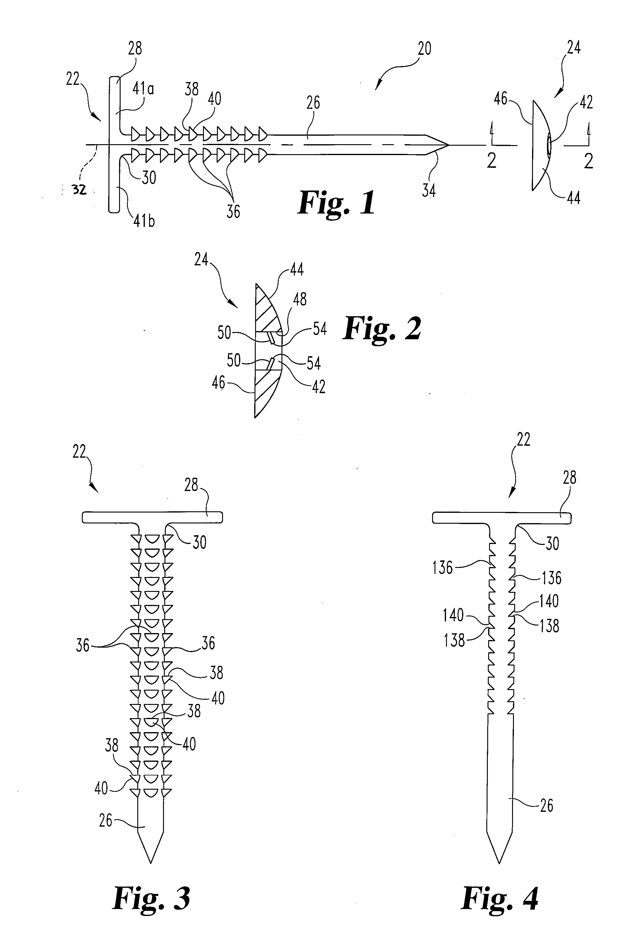 Soft tissue reattachment mechanism