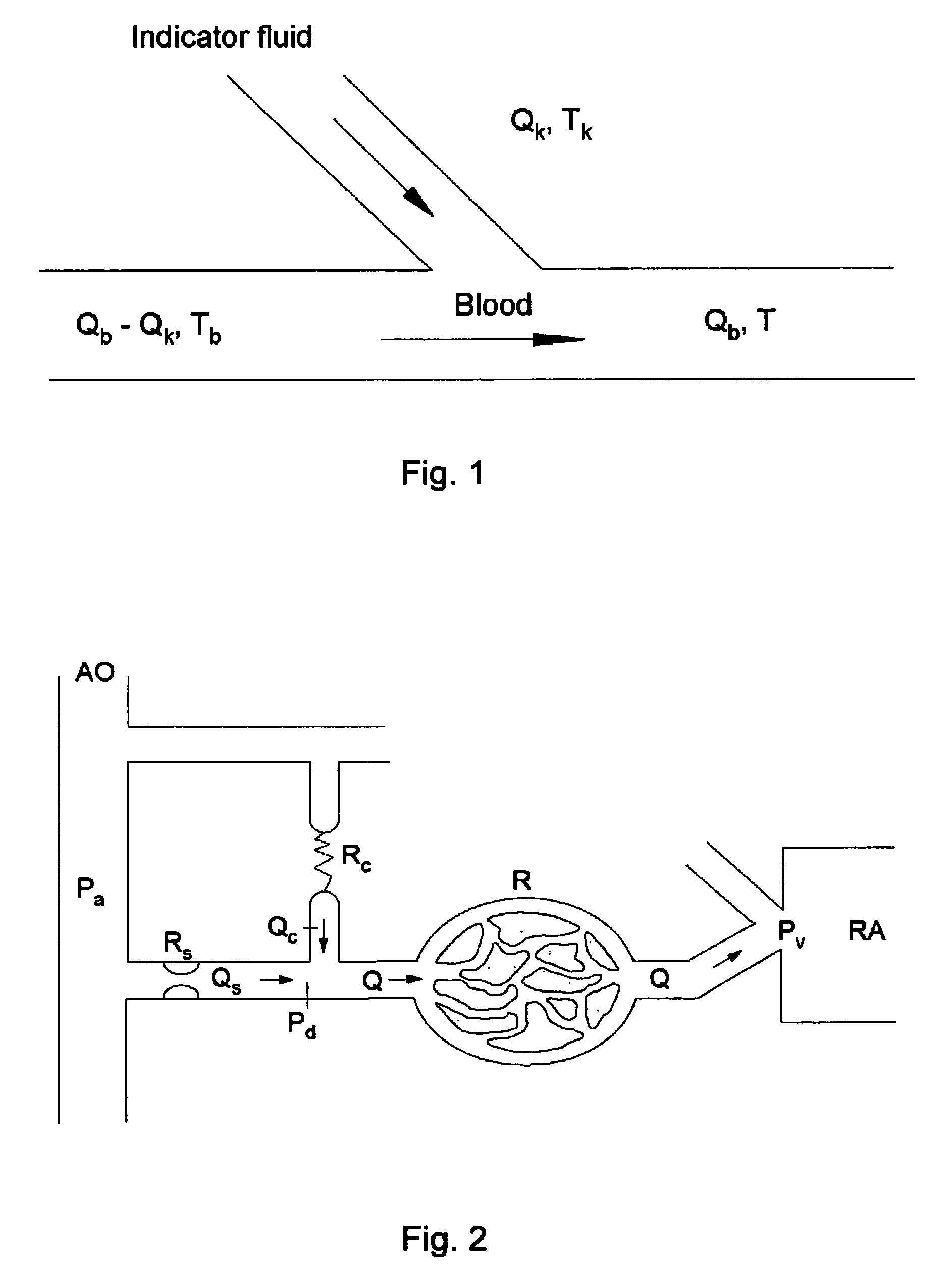 Method for determining the blood flow in a coronary artery
