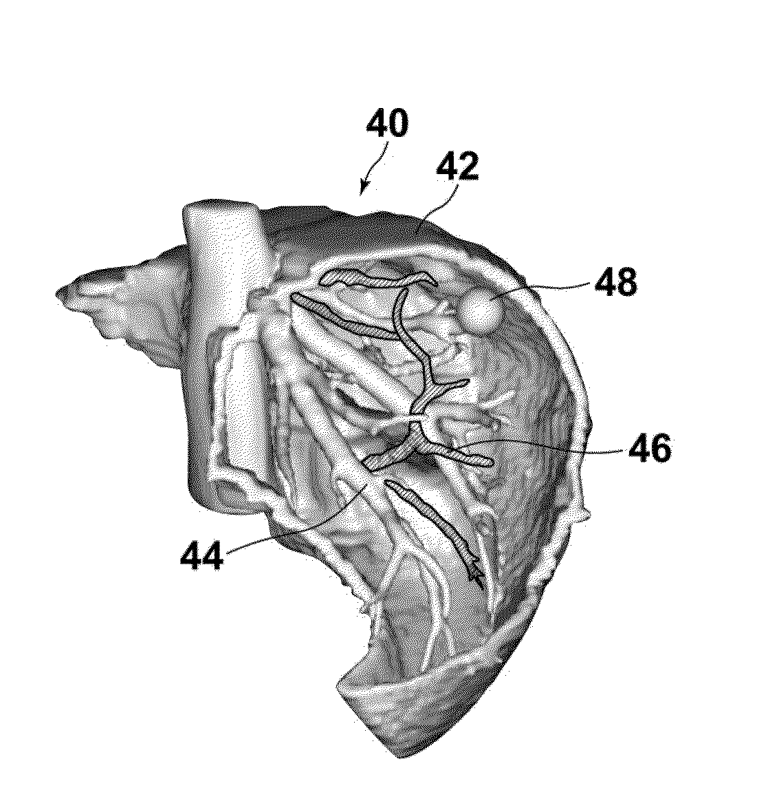 Three-dimensional model data generation device, method and program