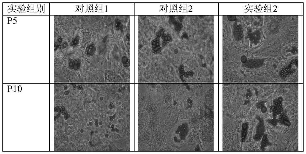 Serum-free medium (SFM) and application thereof in mesenchymal stem cell (MSC) subculture