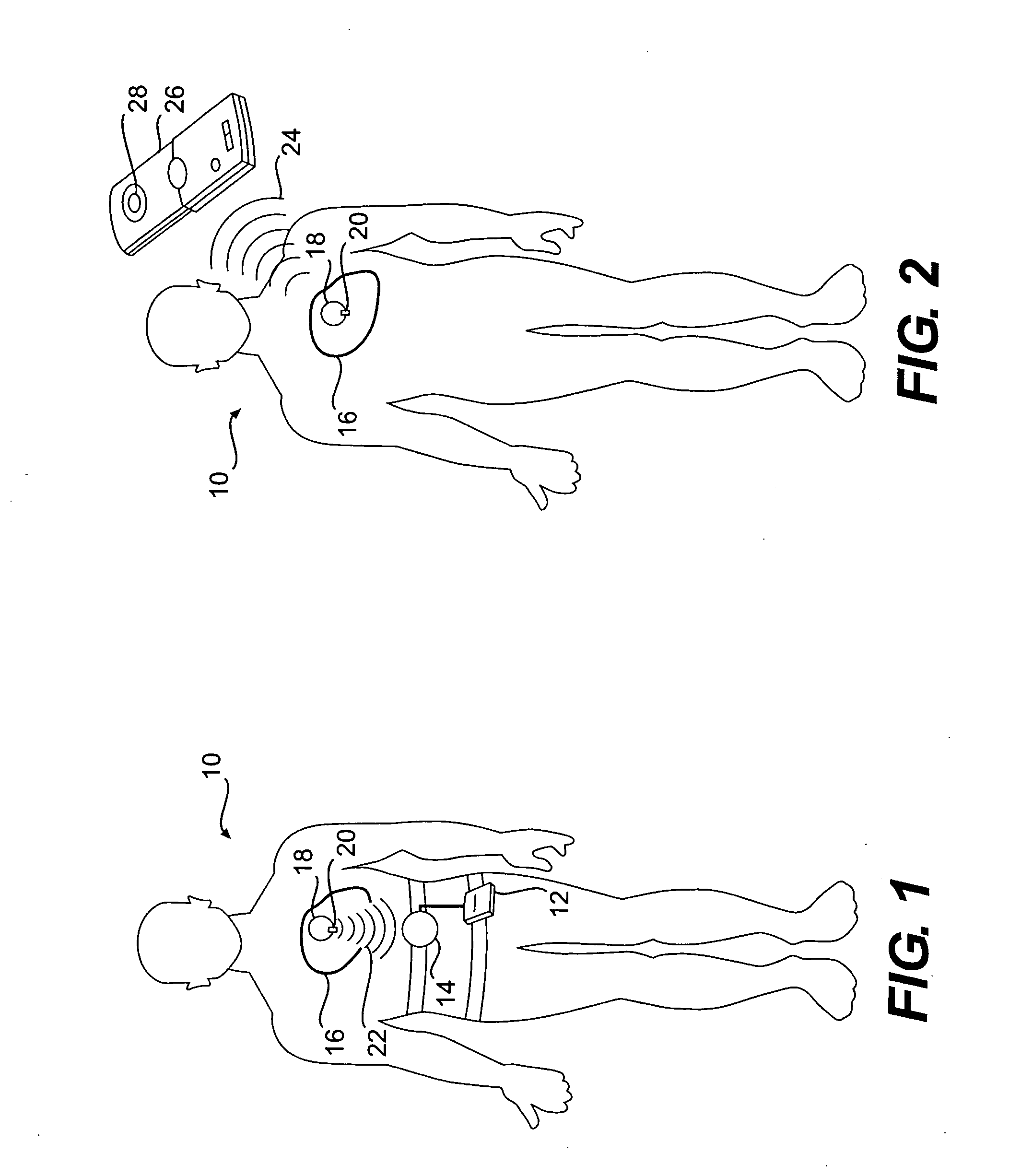 Implantable device for telemetric measurement of blood pressure/temperature within the heart