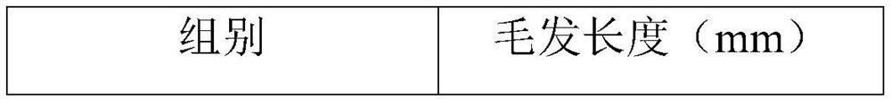 Exosome complex liquid for treating alopecia and preparation method thereof