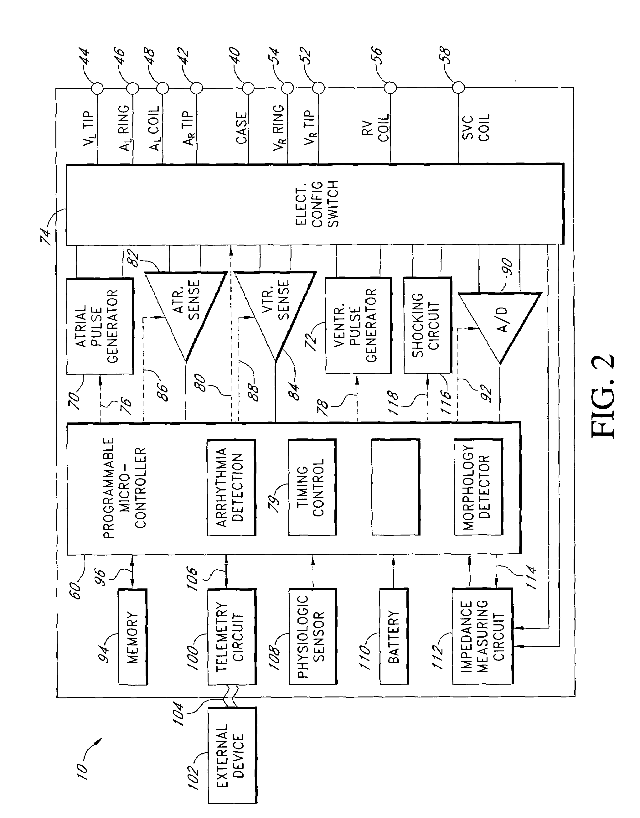 Implantable medical device with automatic sensing adjustment