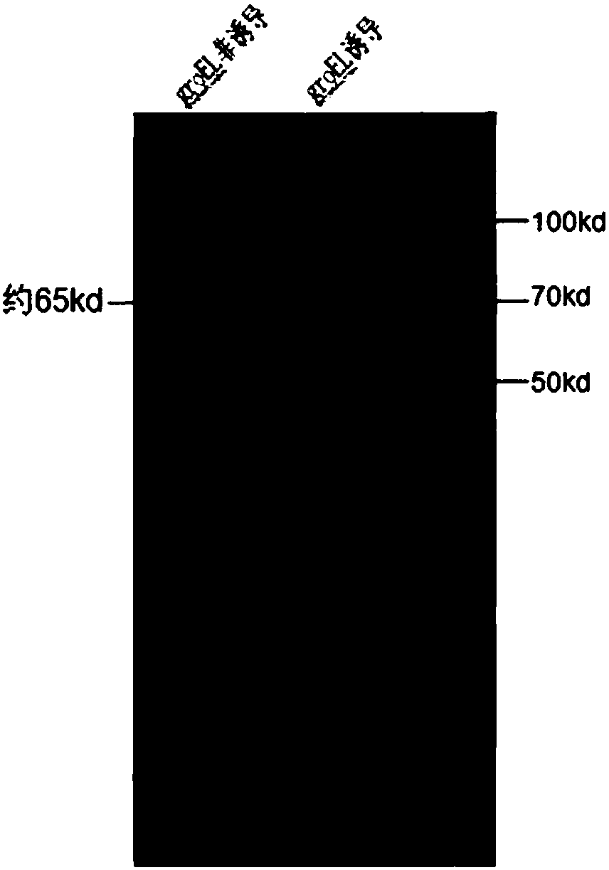 Application of heat shock protein groEL to preparation of reagent for detecting Helicobacter pylori