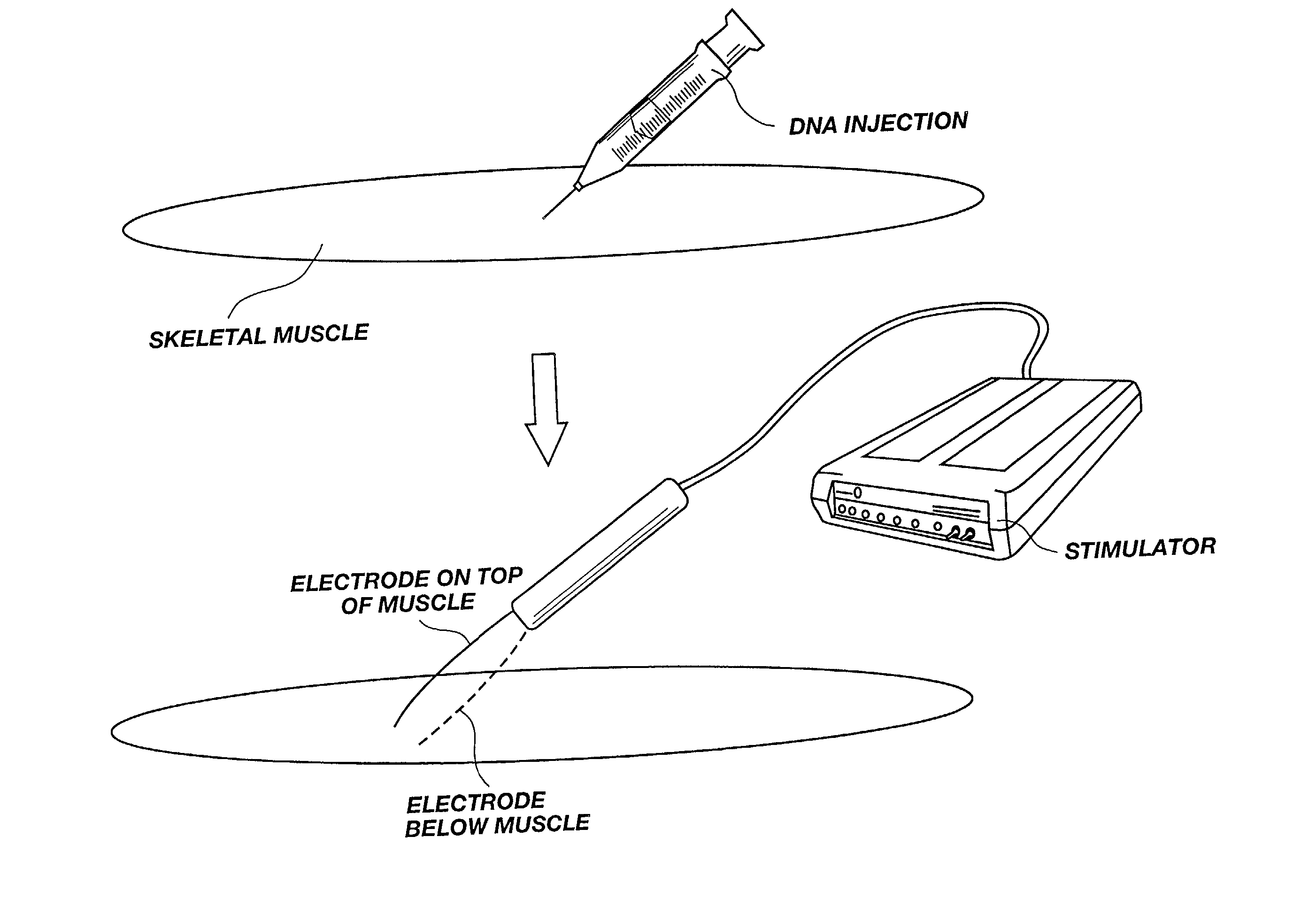 Method for genetic immunization and introduction of molecules into skeletal muscle and immune cells