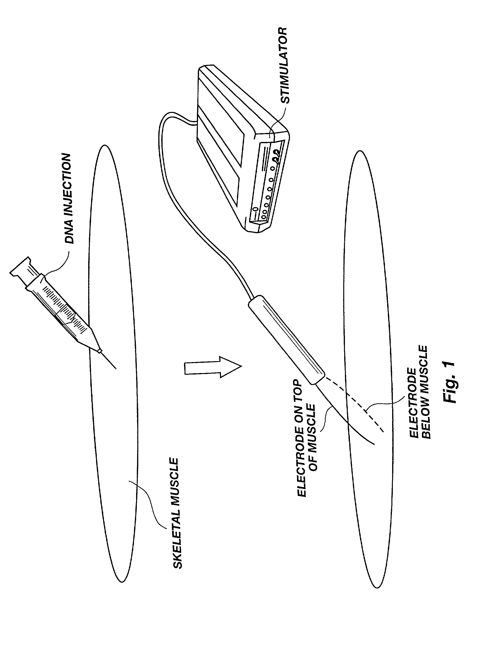 Method for genetic immunization and introduction of molecules into skeletal muscle and immune cells