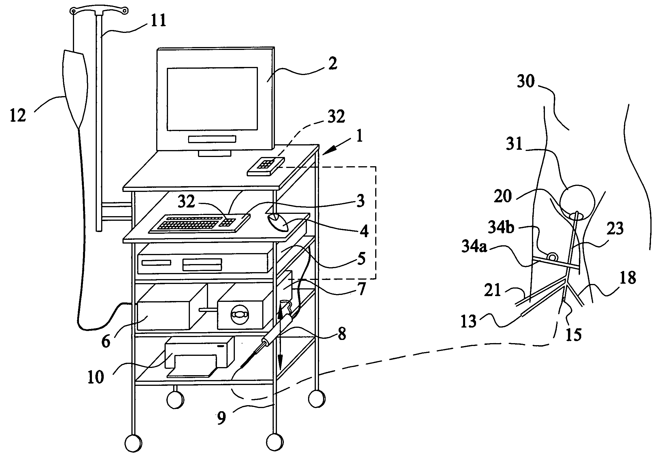 Apparatus and method for the controlled hydrodistention of the urinary bladder