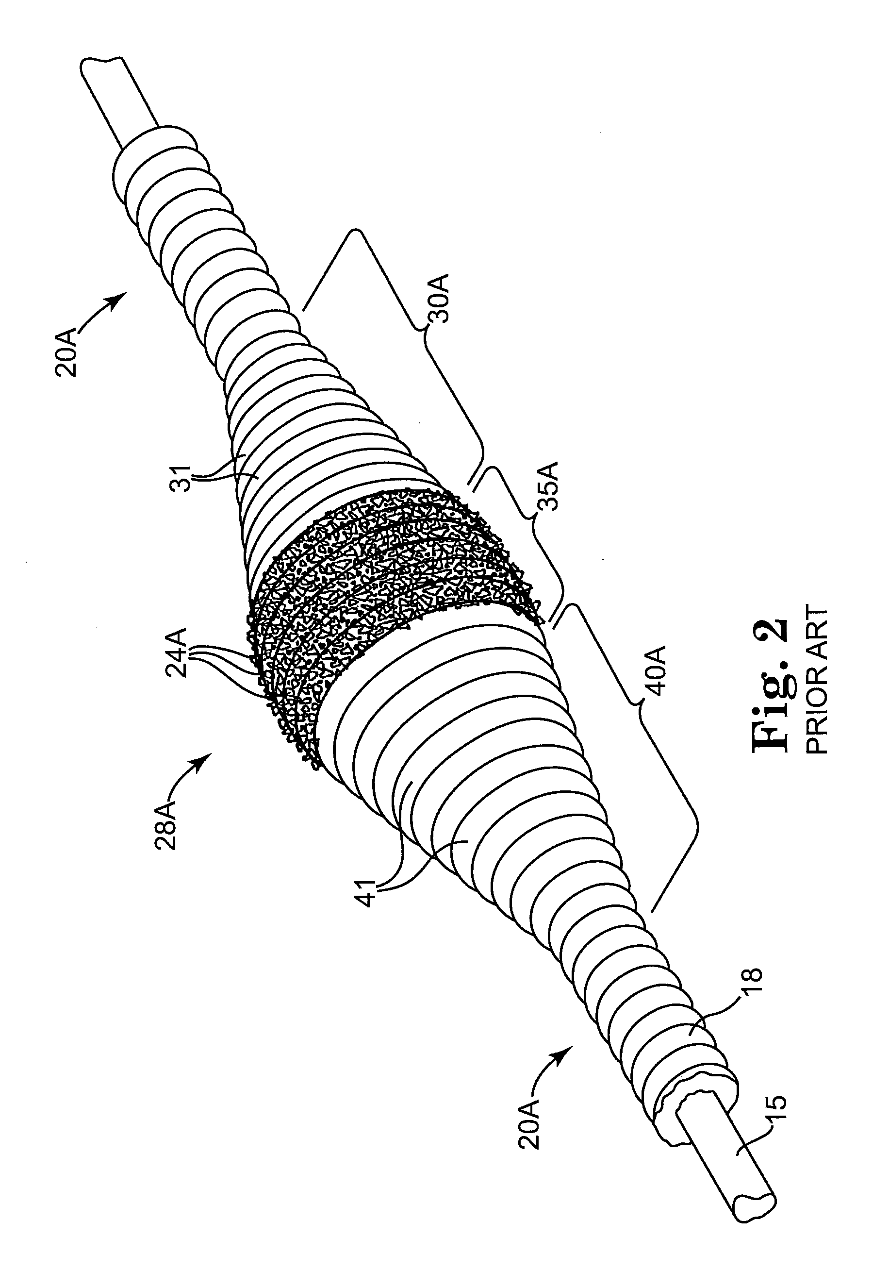 Eccentric abrading head for high-speed rotational atherectomy devices