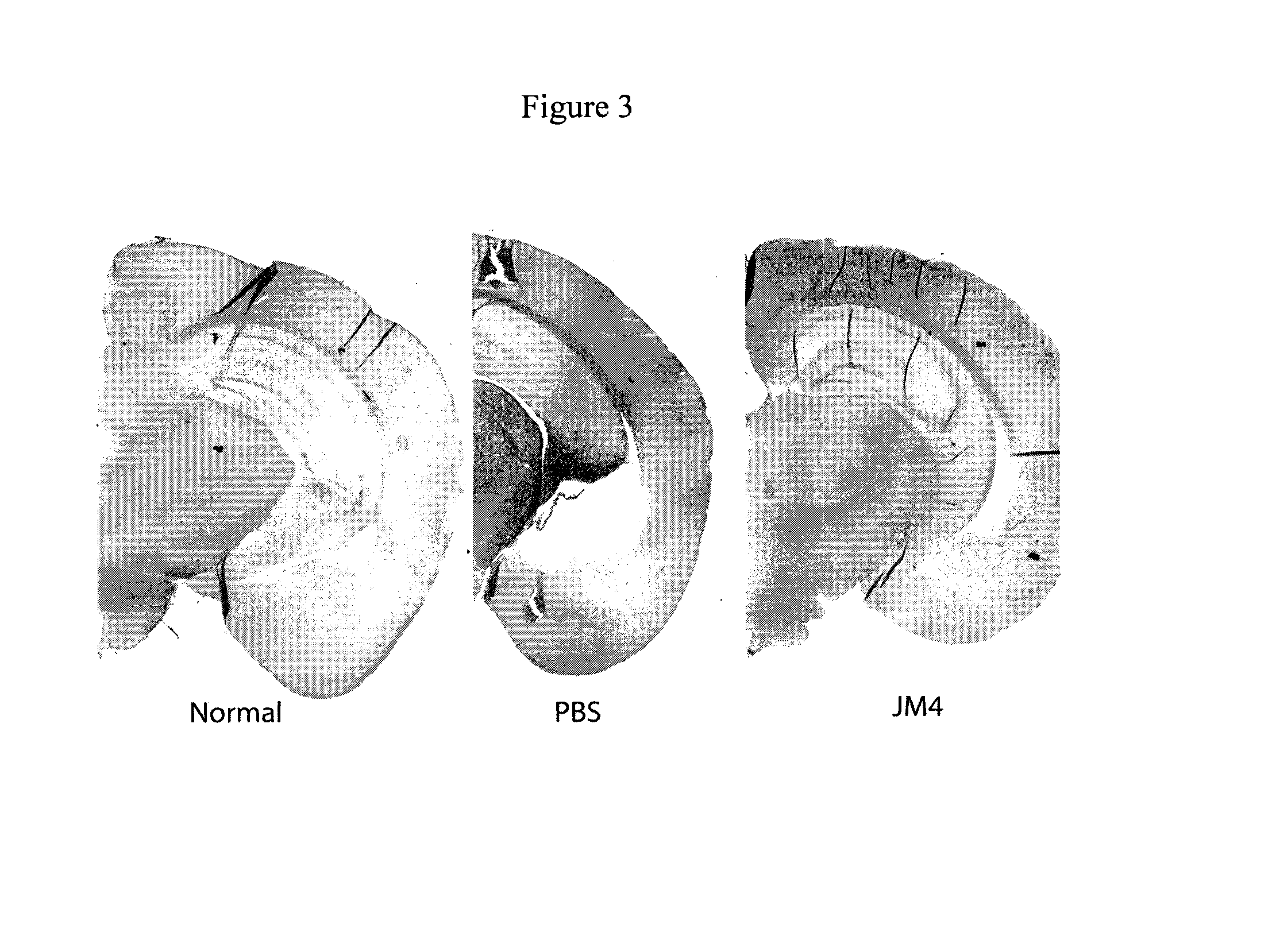 Use of EPO-derived peptide fragments for the treatment of neurodegenerative disorders