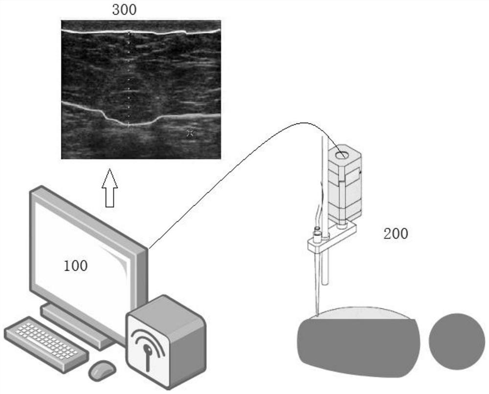 Liposuction surgery system based on Internet of Things