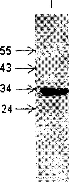 Heavy and light chain variable region gene of monoclonal antibody, encoding polypeptide thereof and use