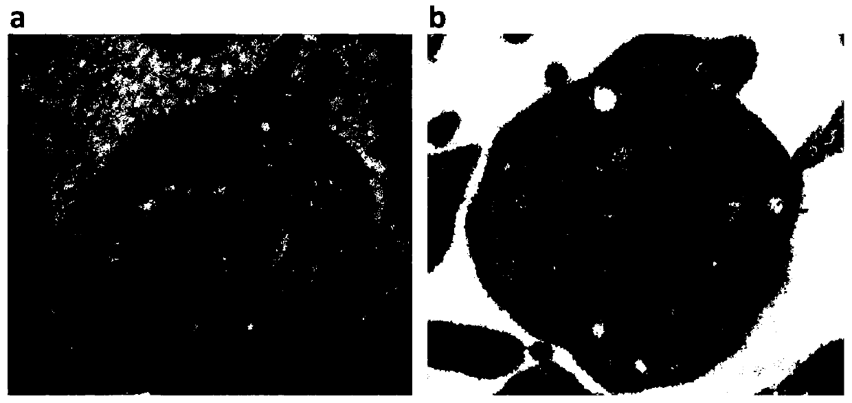 A new type of freeze-dried treatment solution for platelets