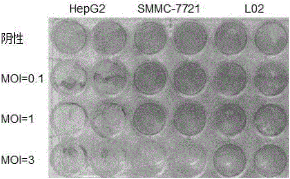 Construction and application of liver cancer targeted oncolytic influenza viruses