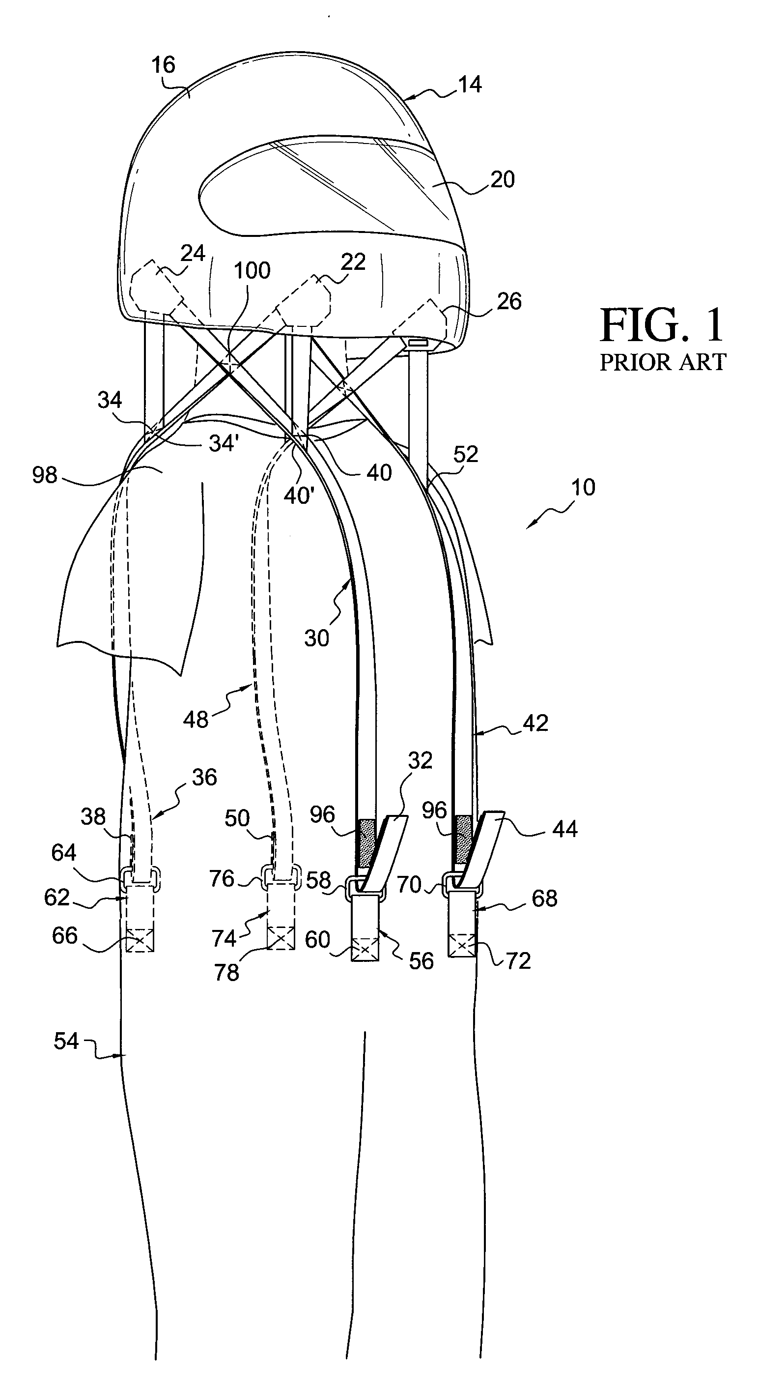 Head and Neck Restraint System