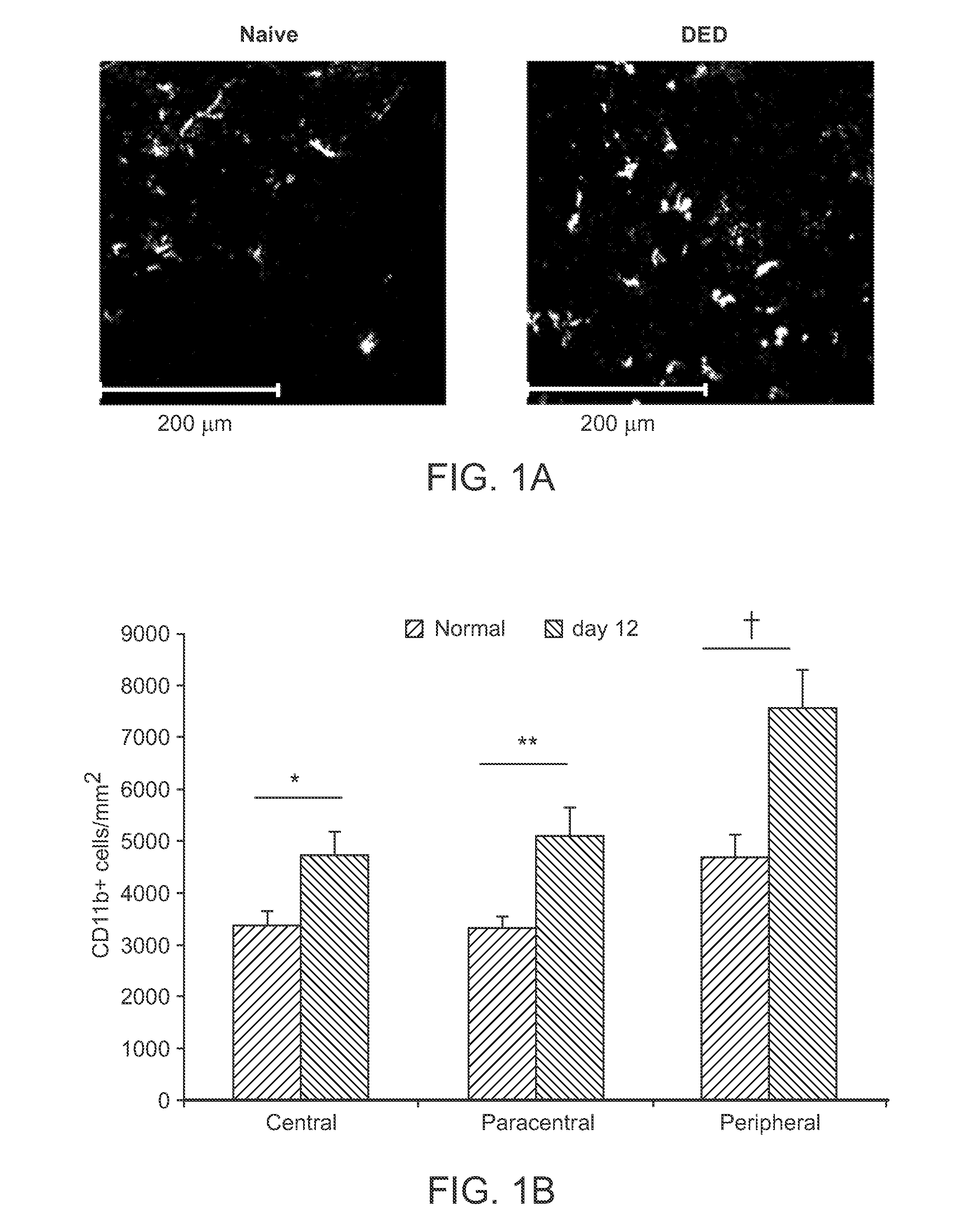 Use of C-C Chemokine Receptor Type 7 (CCR7) Inhibitors