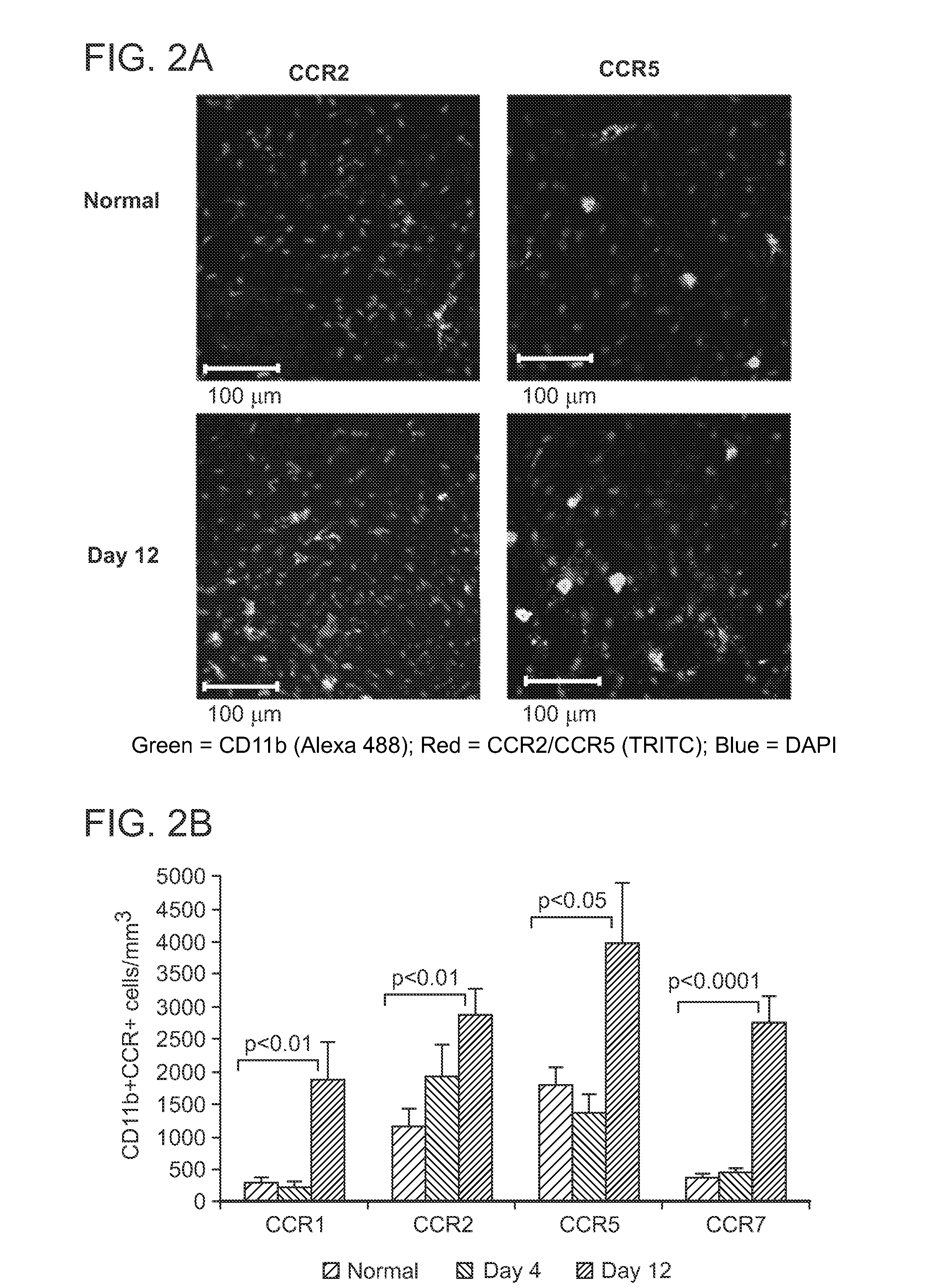 Use of C-C Chemokine Receptor Type 7 (CCR7) Inhibitors