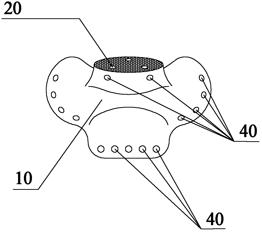 Artificial sacrum prosthesis