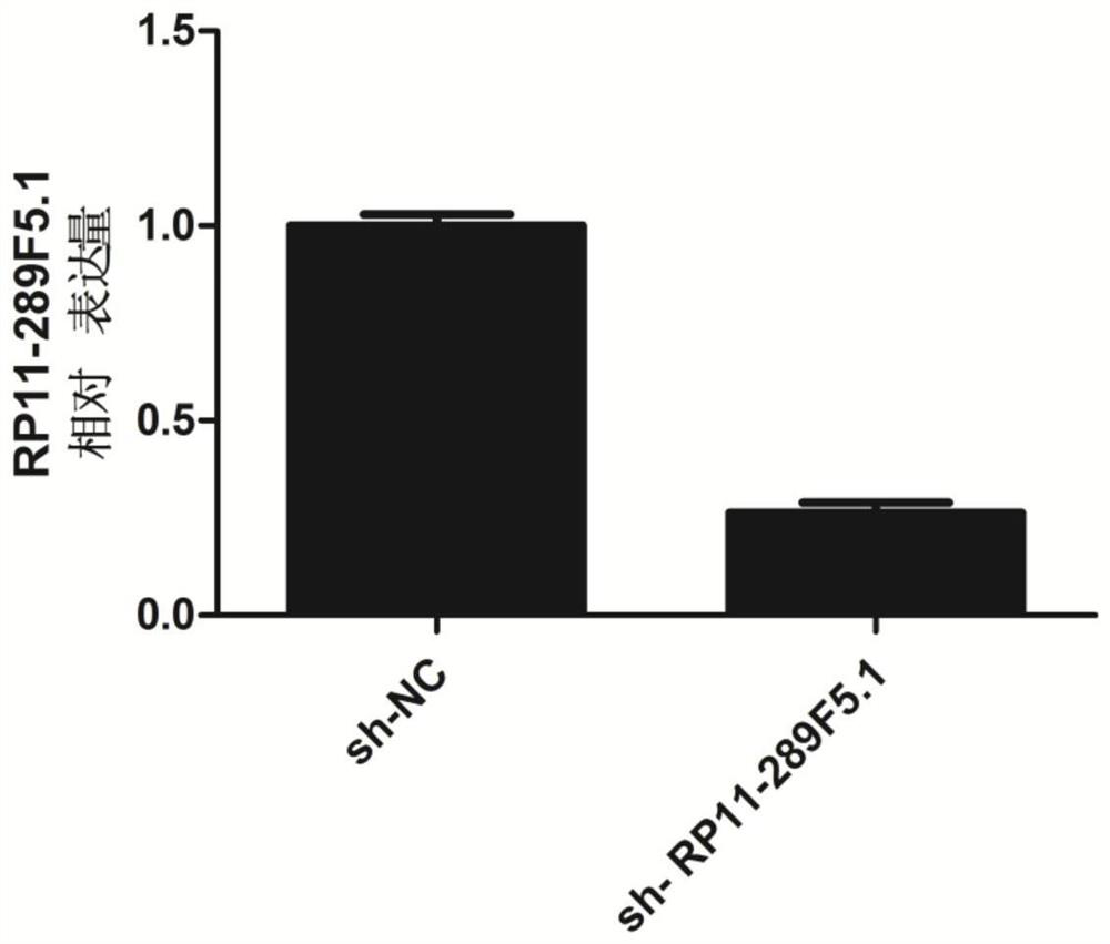 Accelerant for proliferation and osteogenic differentiation of periodontal ligament stem cell