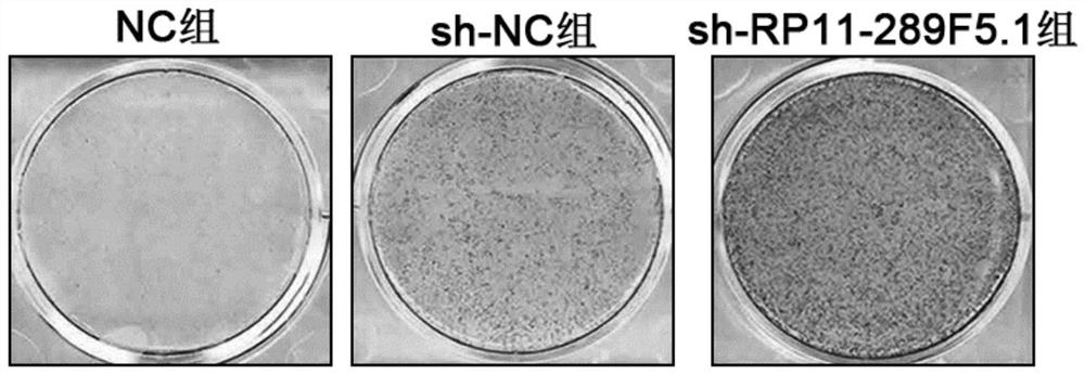 Accelerant for proliferation and osteogenic differentiation of periodontal ligament stem cell