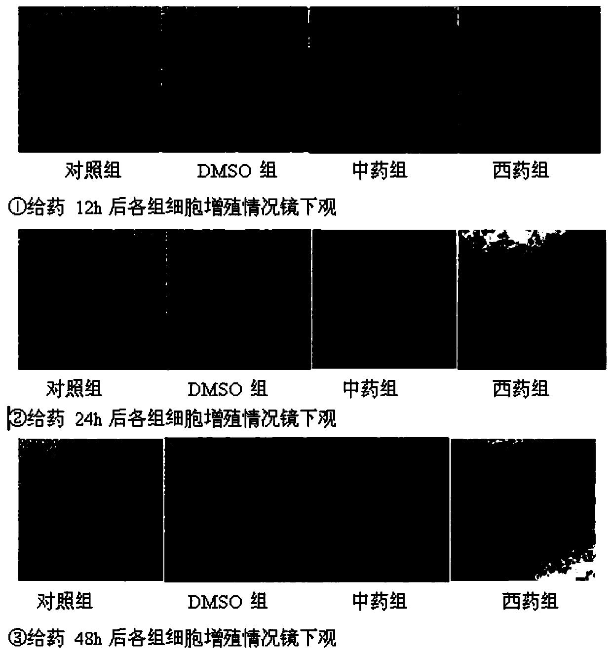 Medicine for chronic obstructive pulmonary disease complicated mesothelioma and preparation method of medicine