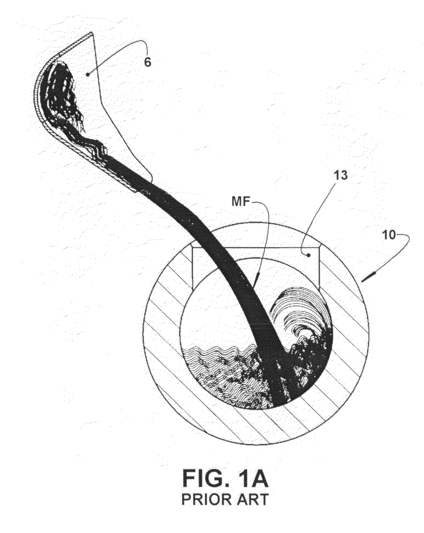 Injection chamber for a metal injection machine