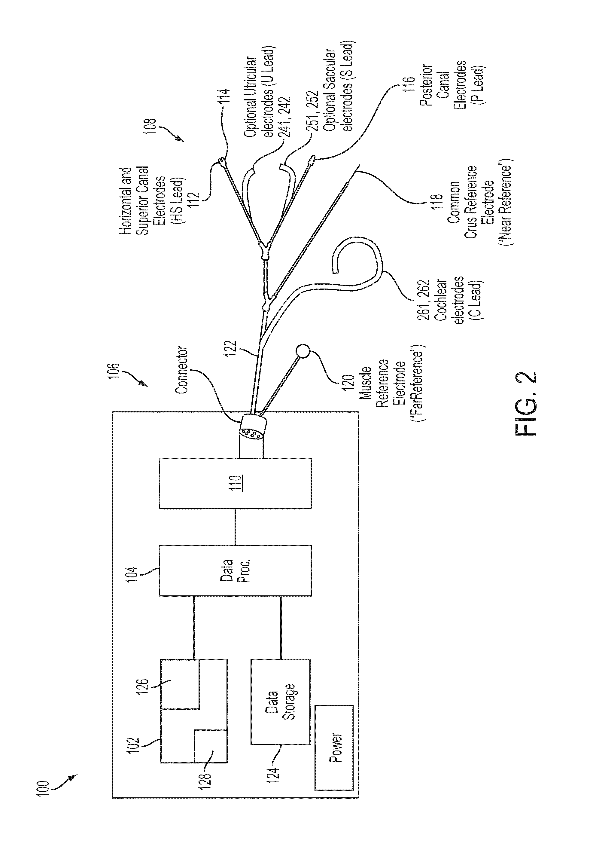 Implantable vestibular prosthesis