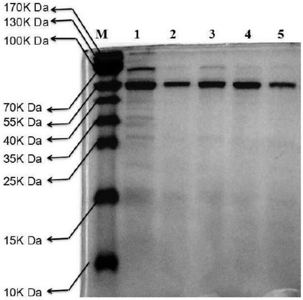 Novel staphylococcal phage and its composition, preparation method and application