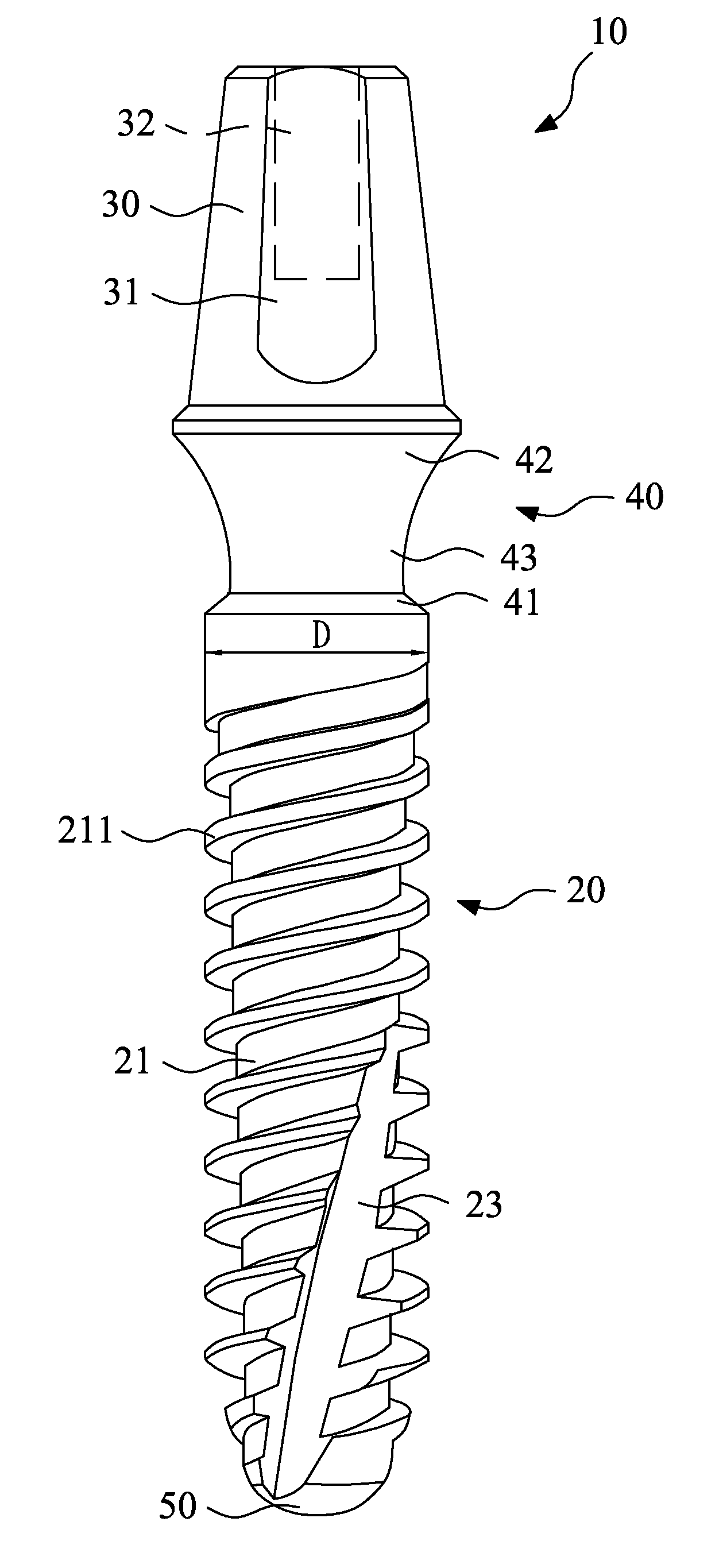 Dental implant