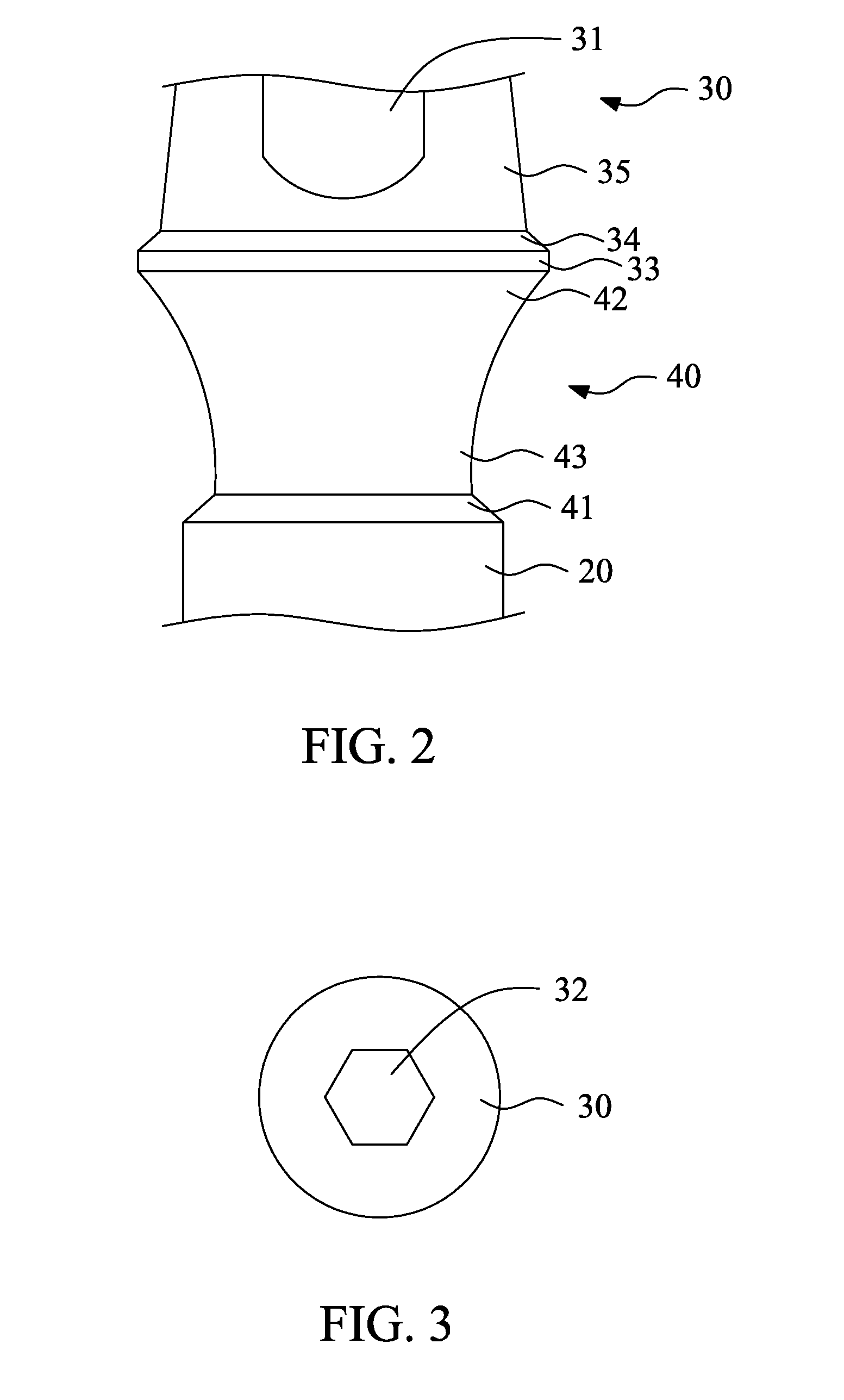 Dental implant