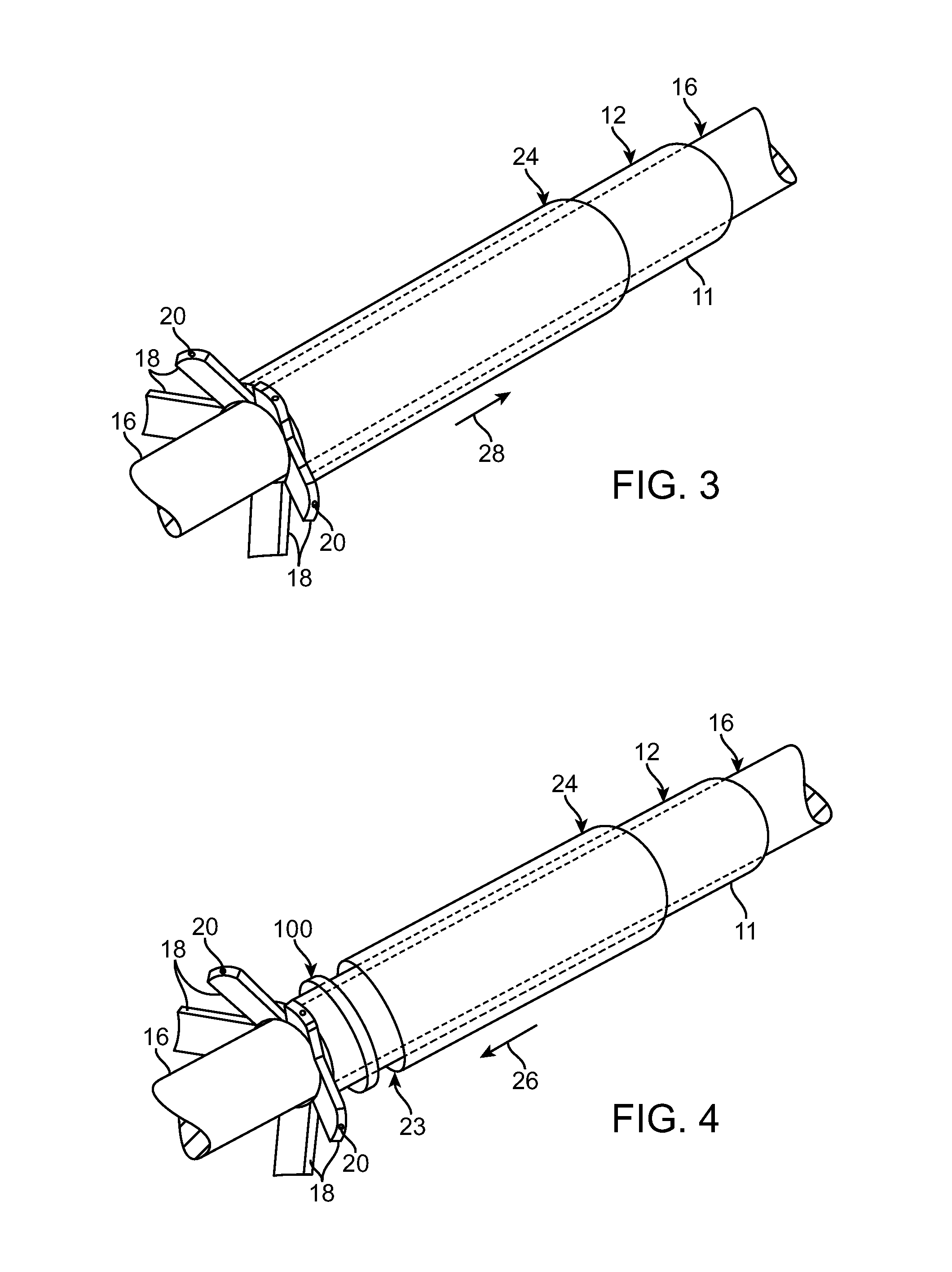 Mechanism and Method for Closing an Arteriotomy