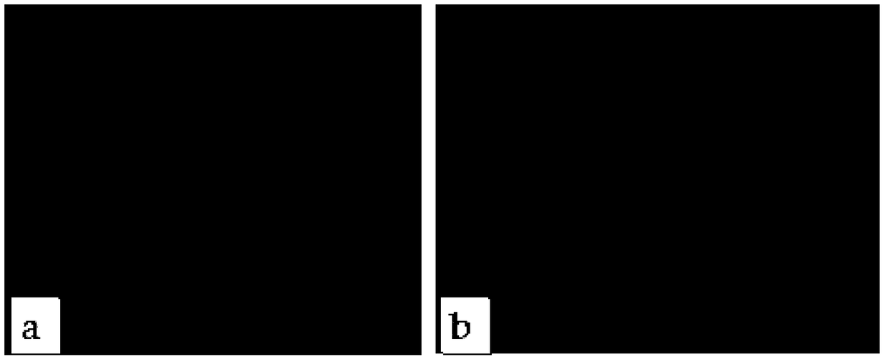 Propranolol hydrochloride external gel preparation and its preparation method and application