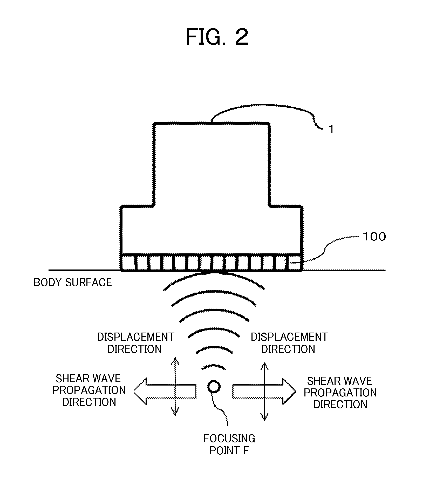 Apparatus and method for ultrasonic diagnosis