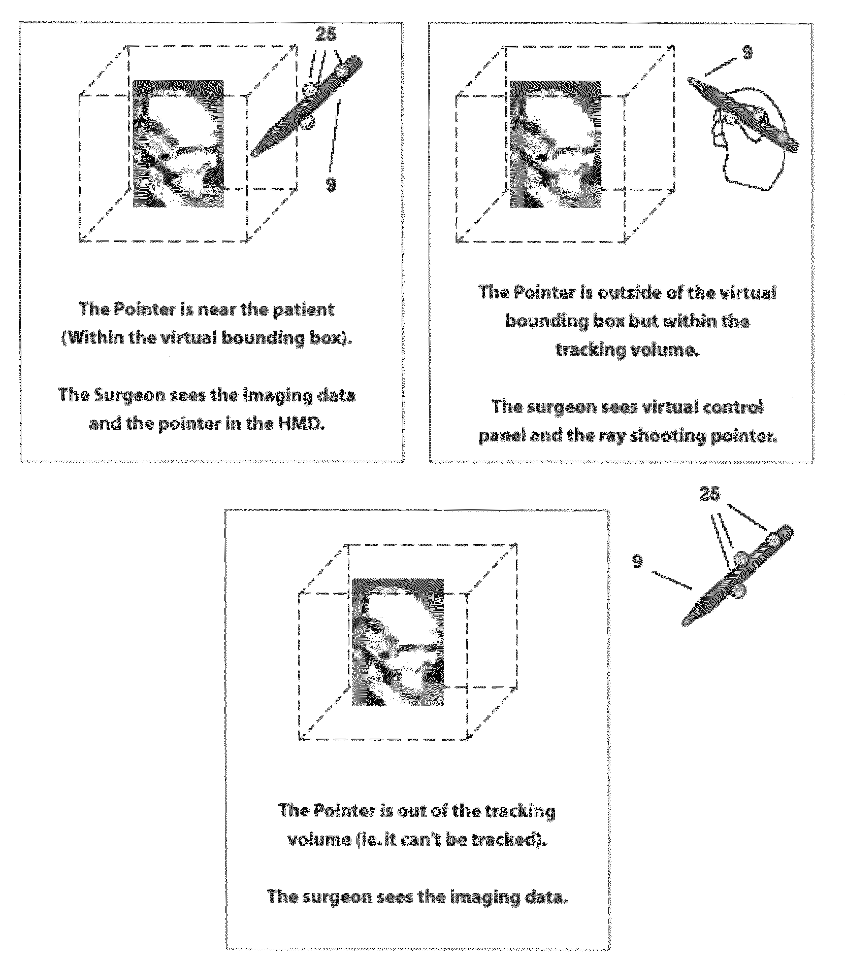 Augmented reality system controlled by probe position