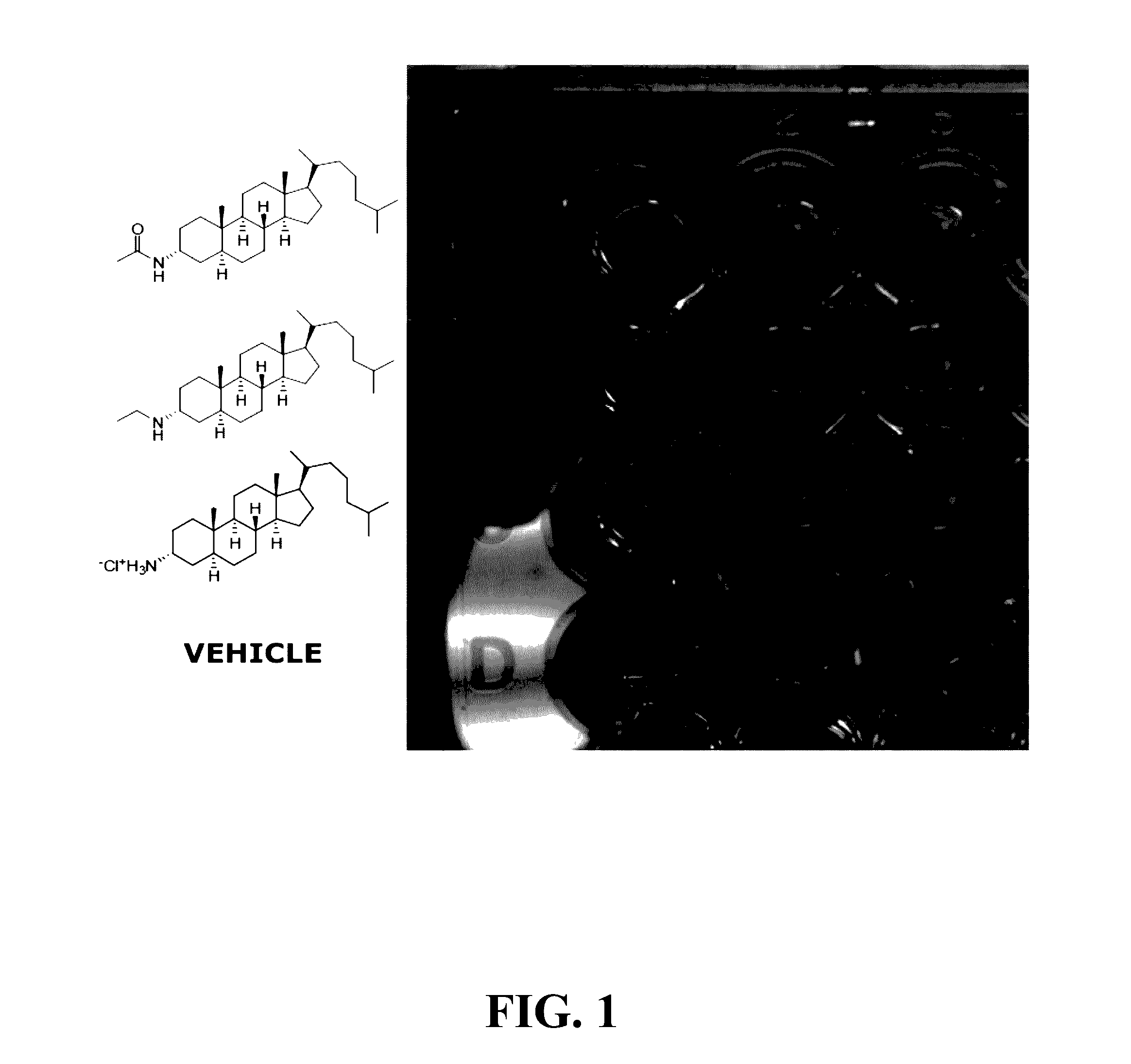 Ship inhibitors and uses thereof