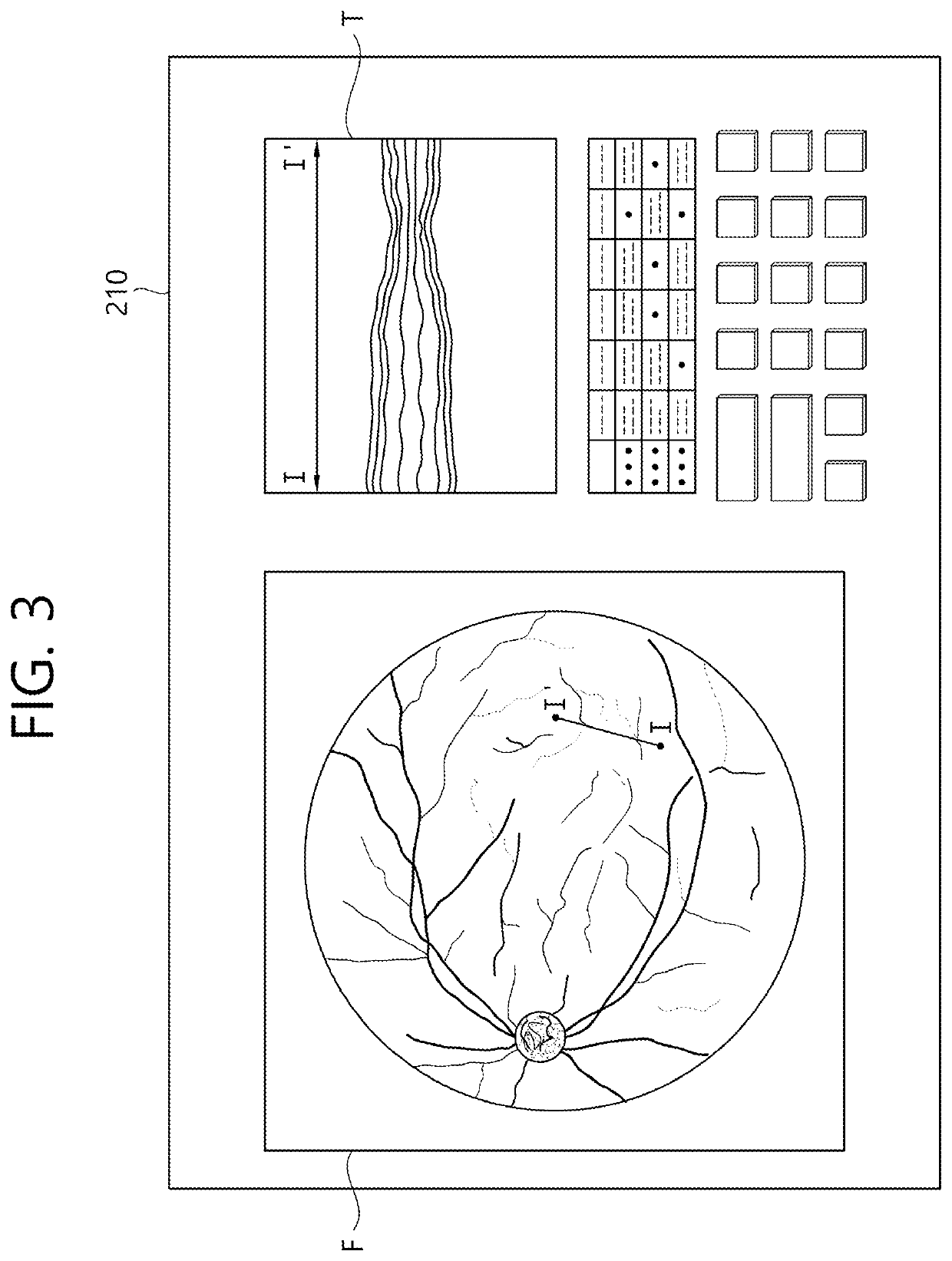 Ophthalmic therapeutic device and control method therefor