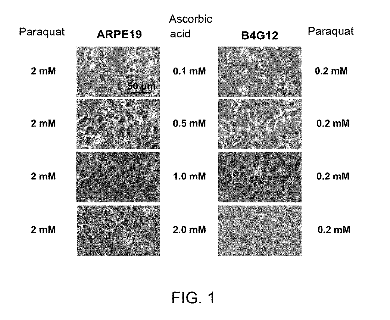 Method for protecting corneal endothelial cells from the impact caused by an eye surgery