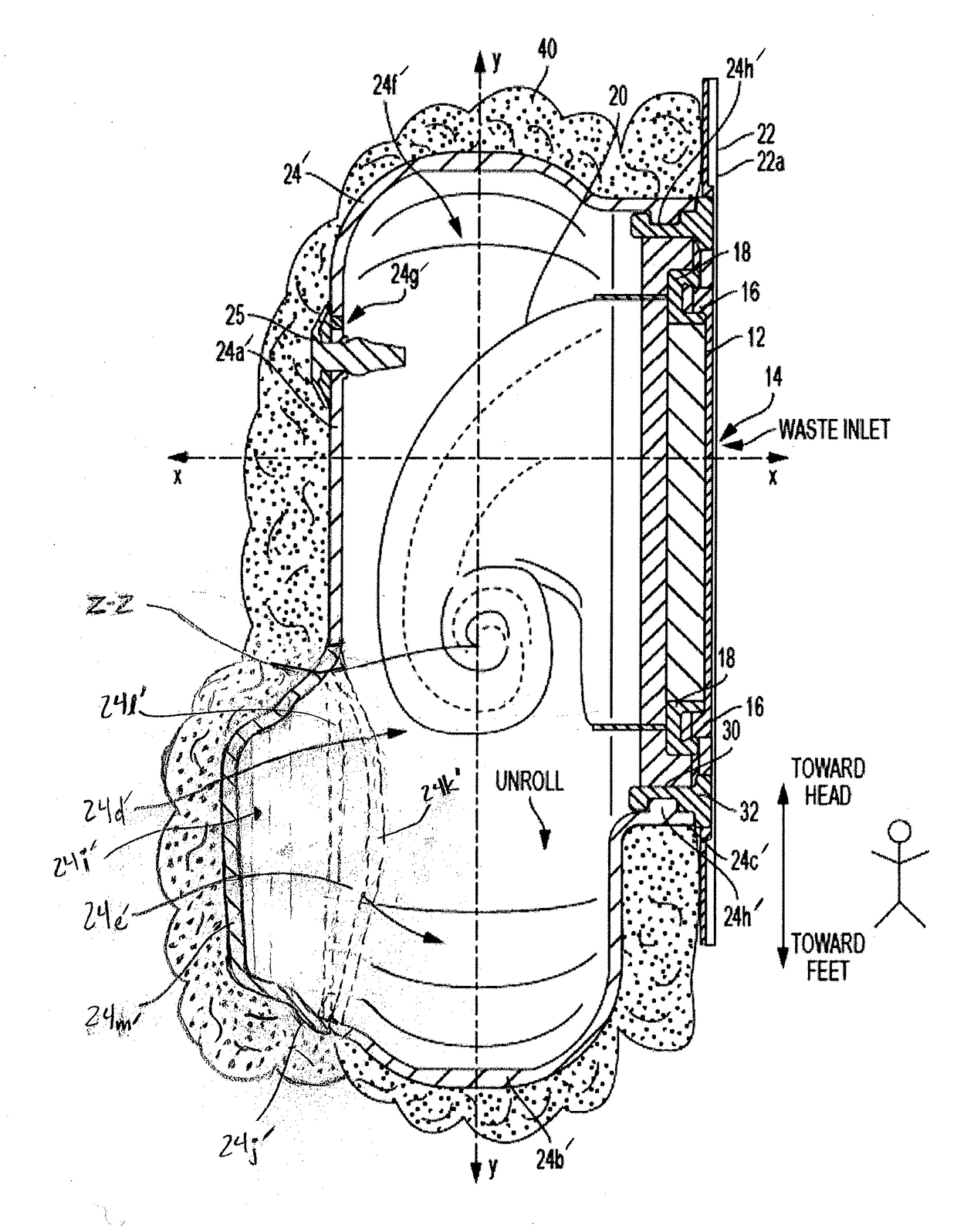 Ostomy appliance