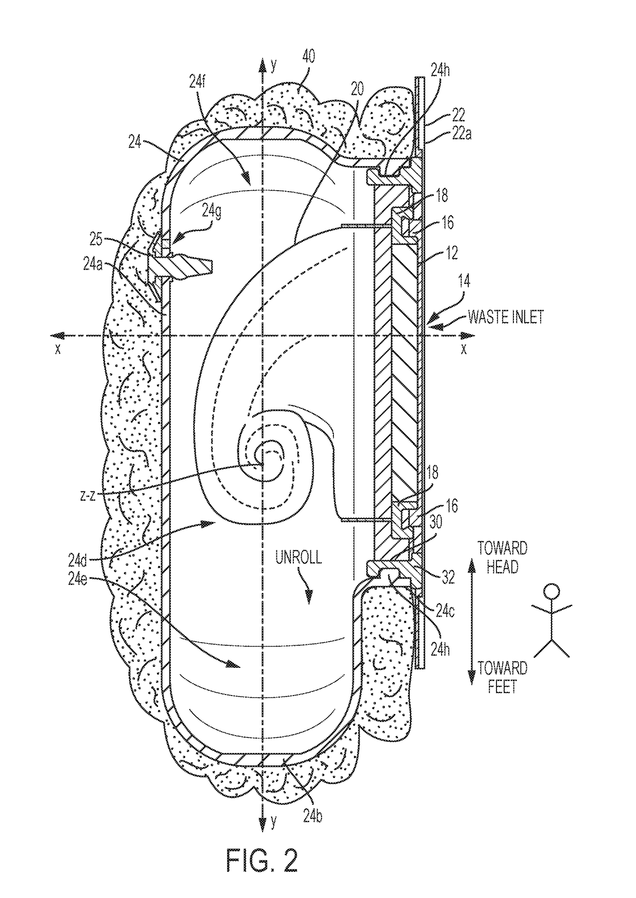 Ostomy appliance