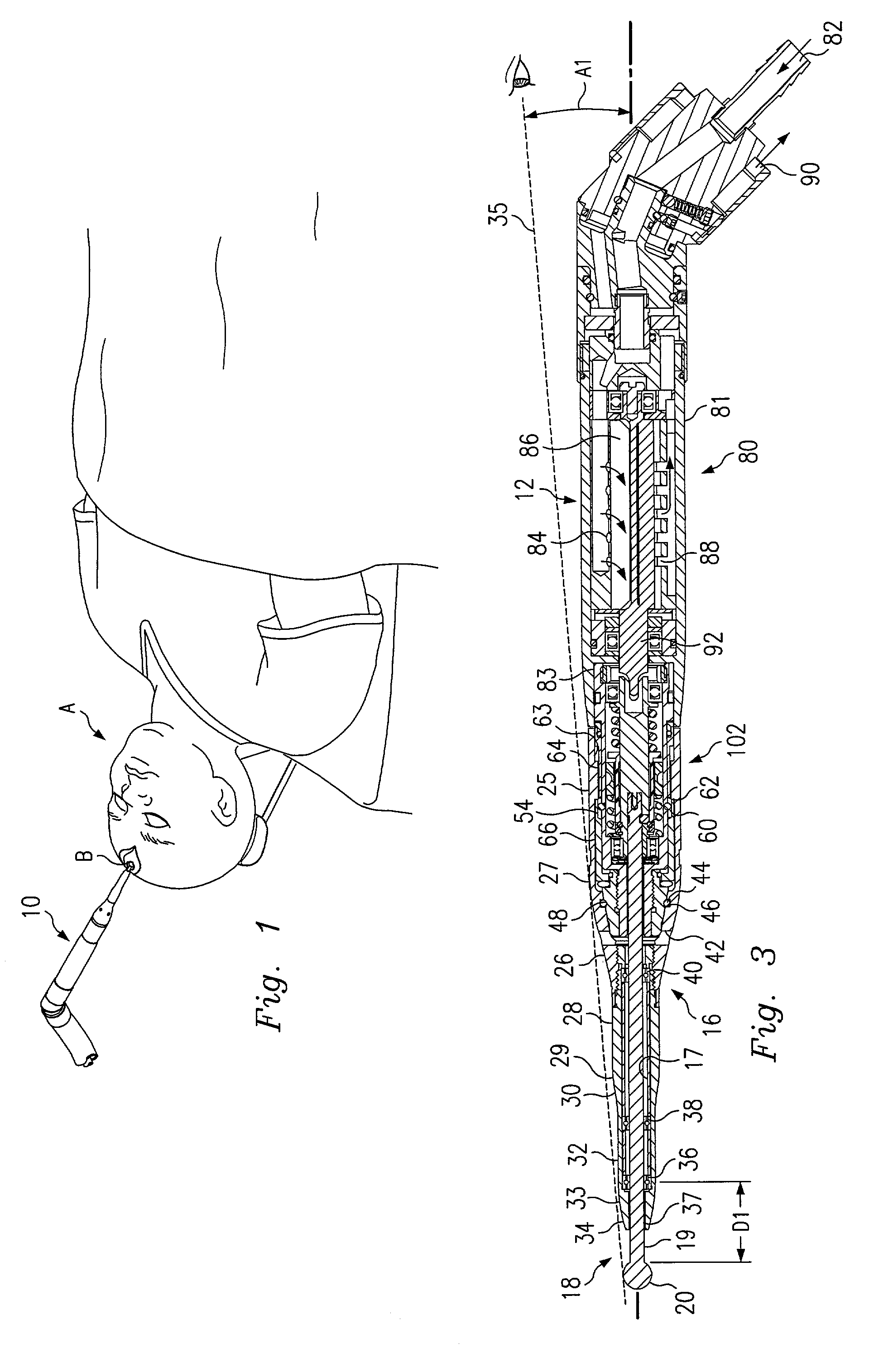 Surgical instrument with rotary cutting member and quick release coupling arrangement