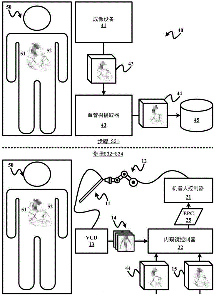 Invisible bifurcation detection within vessel tree images