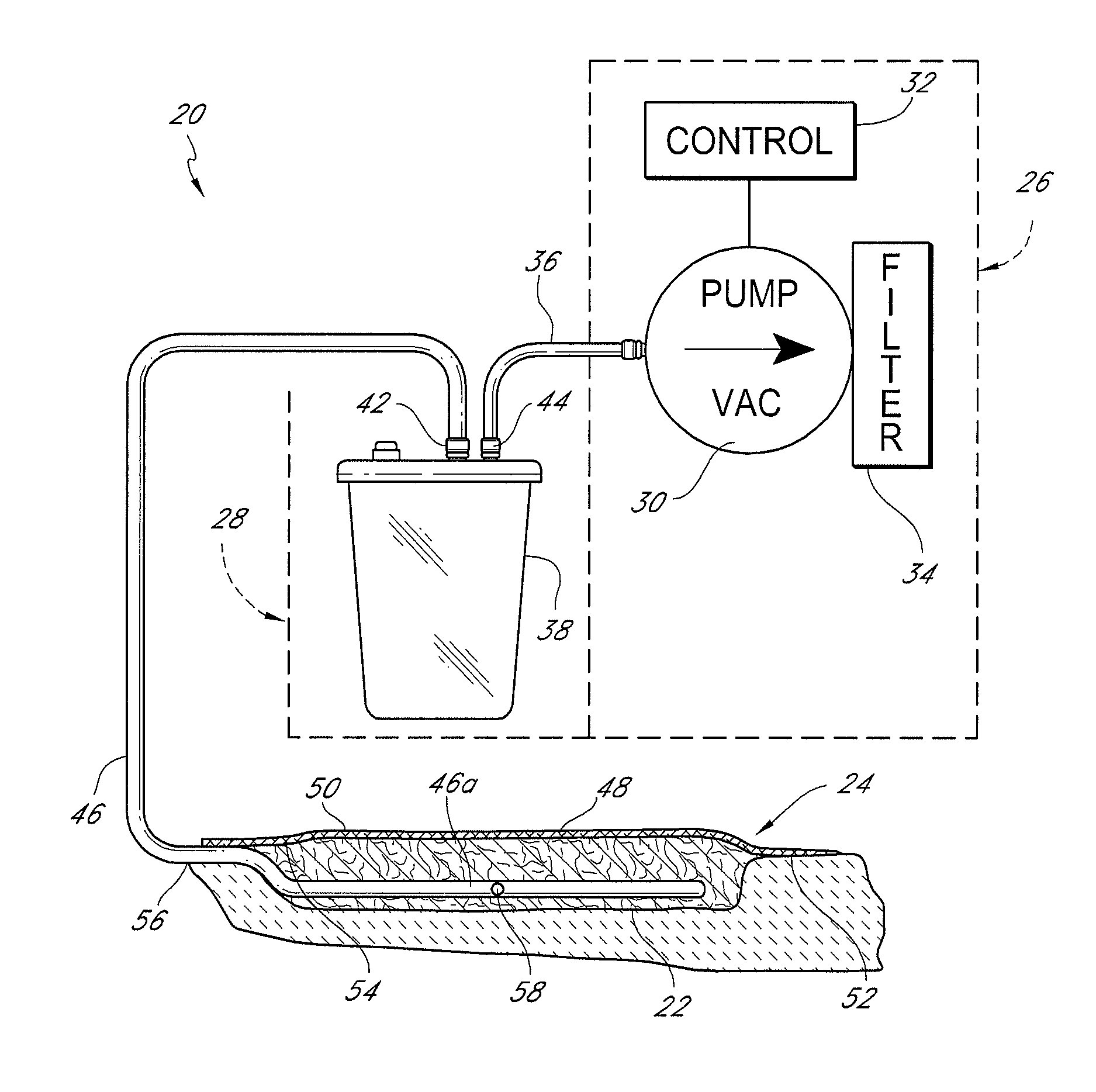 Auxiliary powered negative pressure wound therapy apparatuses and methods