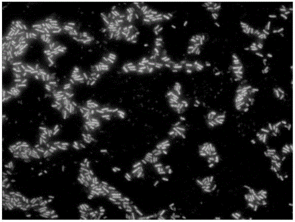 Probe, reagent kit and method for detecting bacteria in sputum