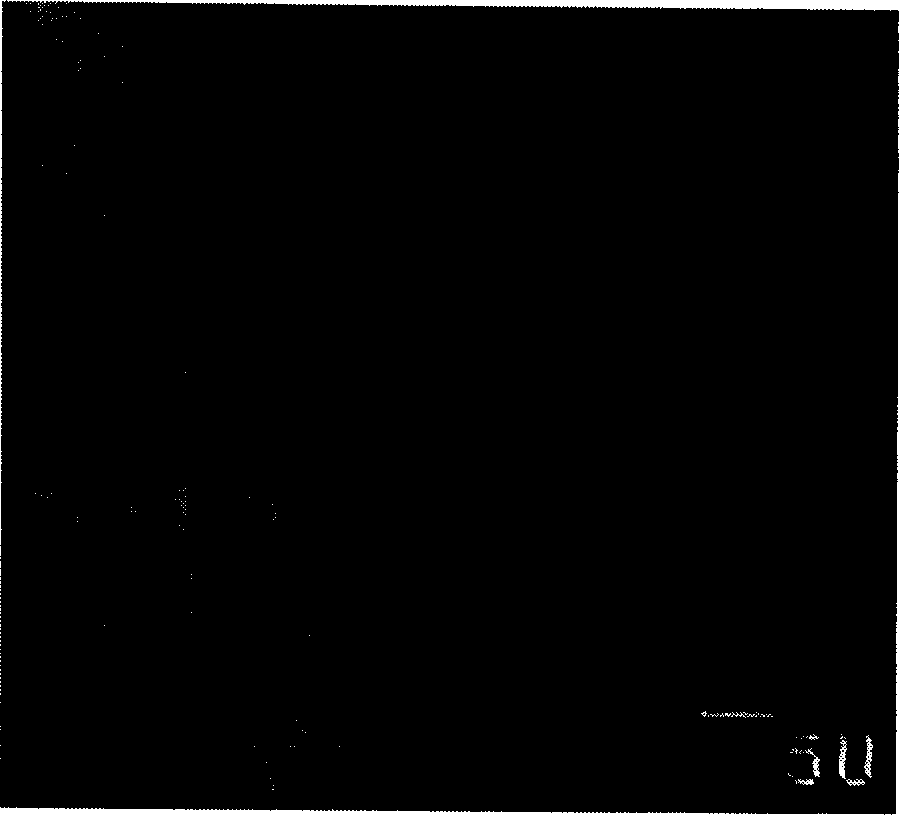 Composite biological medical materials of nano-hydroxy-apatite/silicon rubber and its preparation