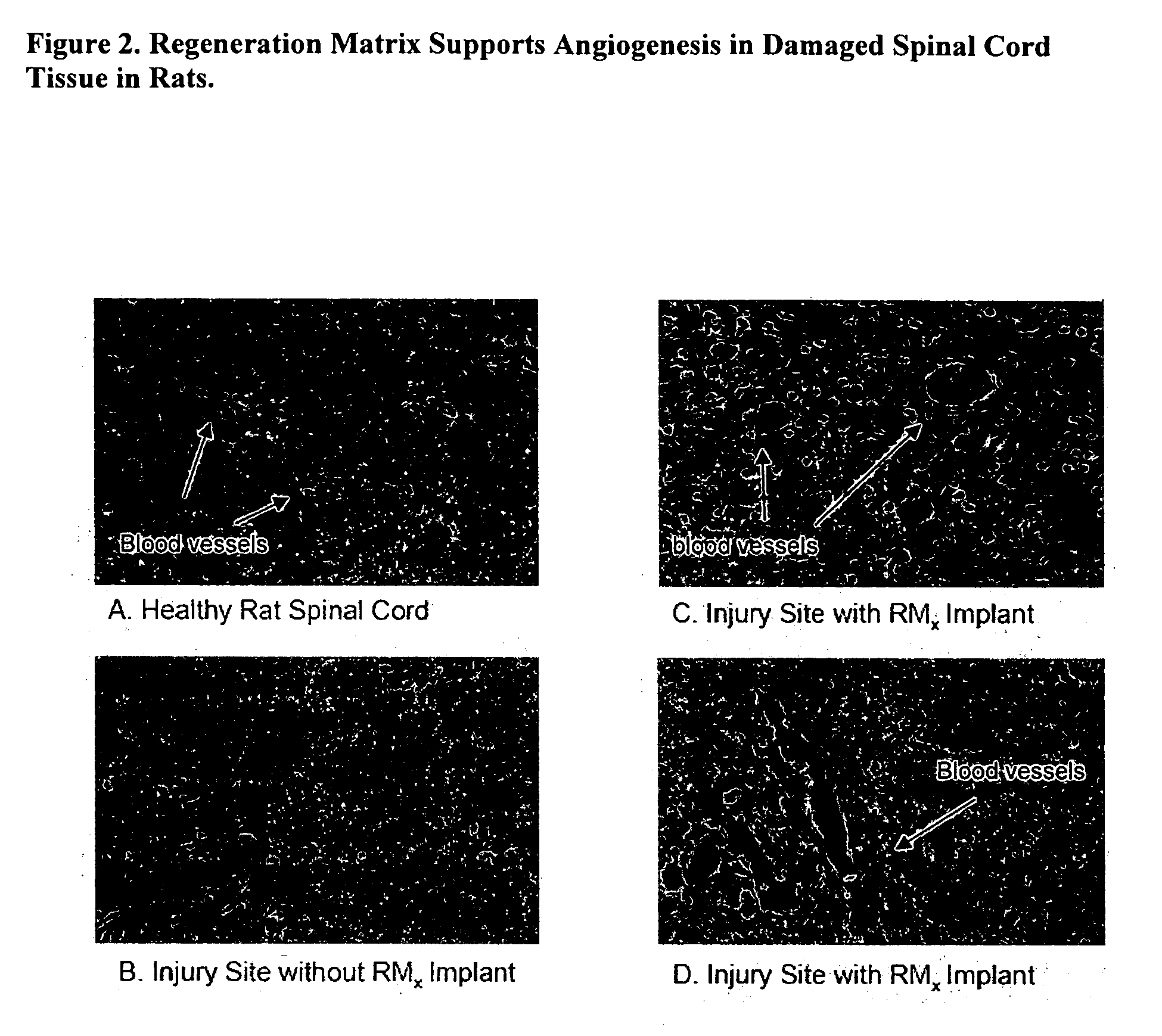 Acellular bioabsorbable tissue regeneration matrices