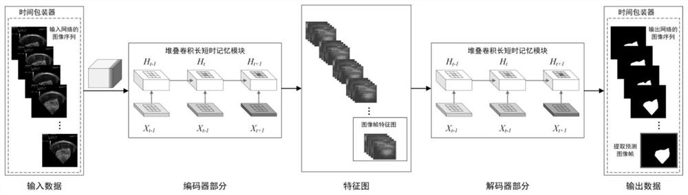 A method of dynamic soft tissue motion prediction for HIFU treatment system