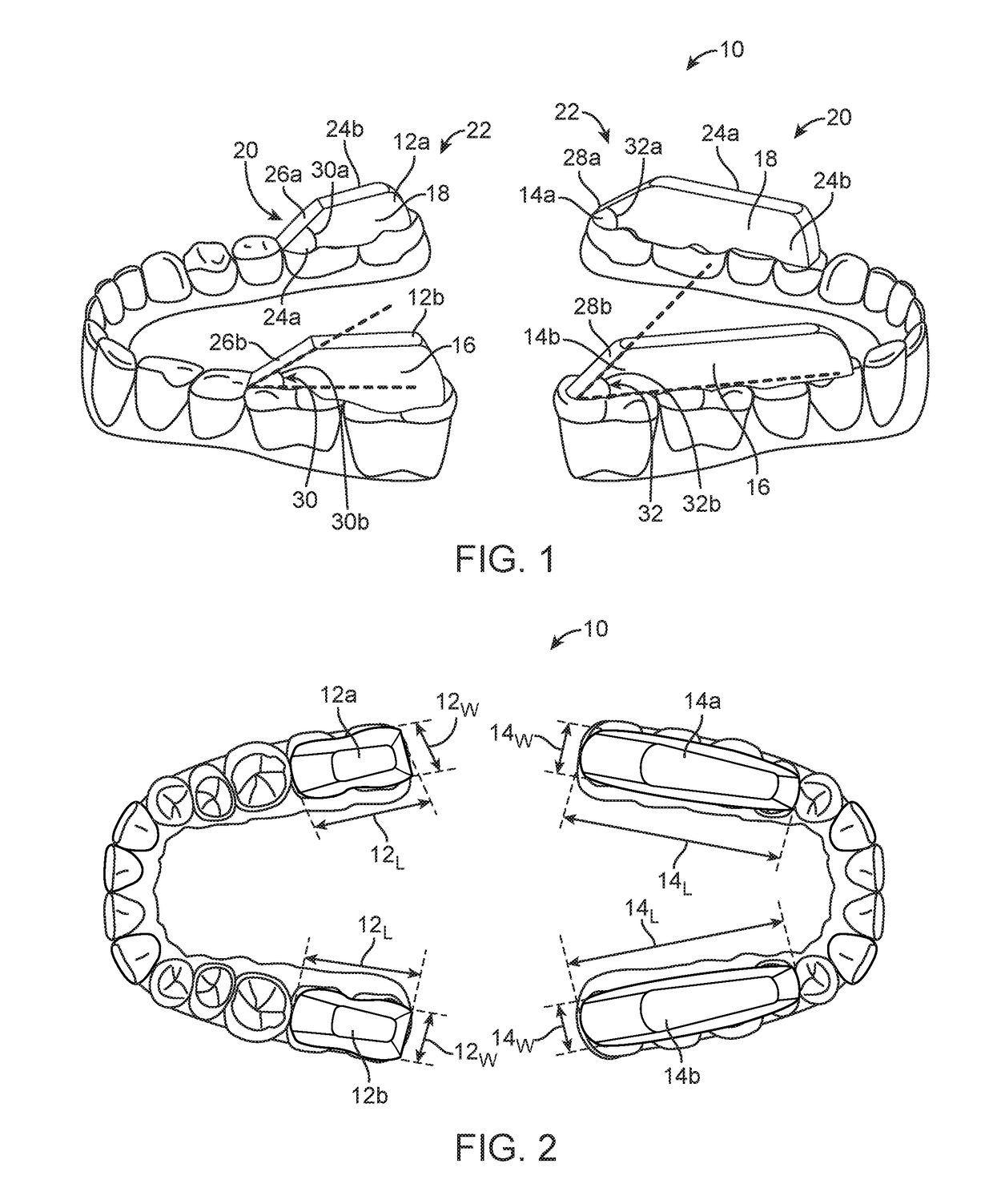 Combined orthodontic movement of teeth with airway development therapy