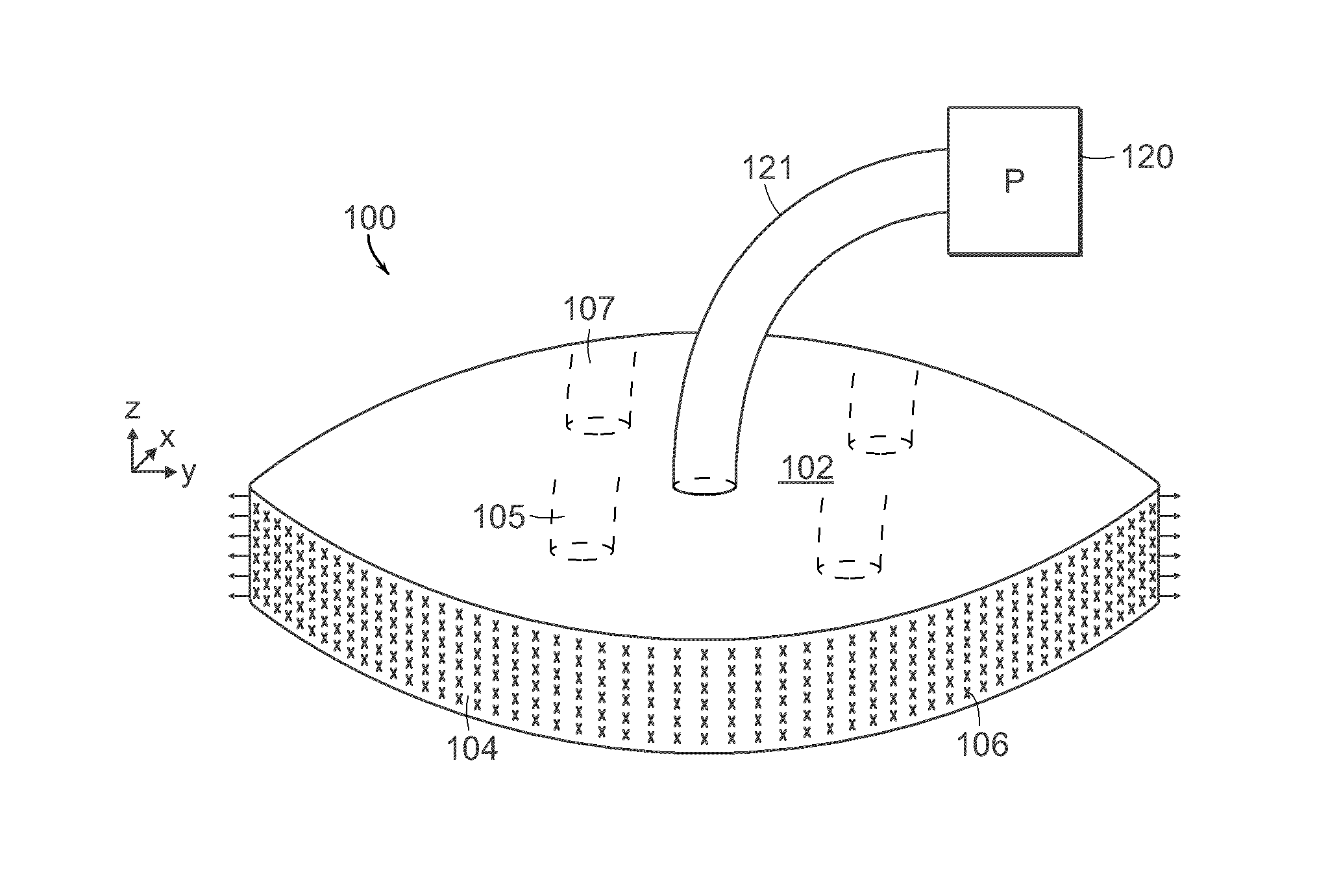 Negative pressure wound closure device