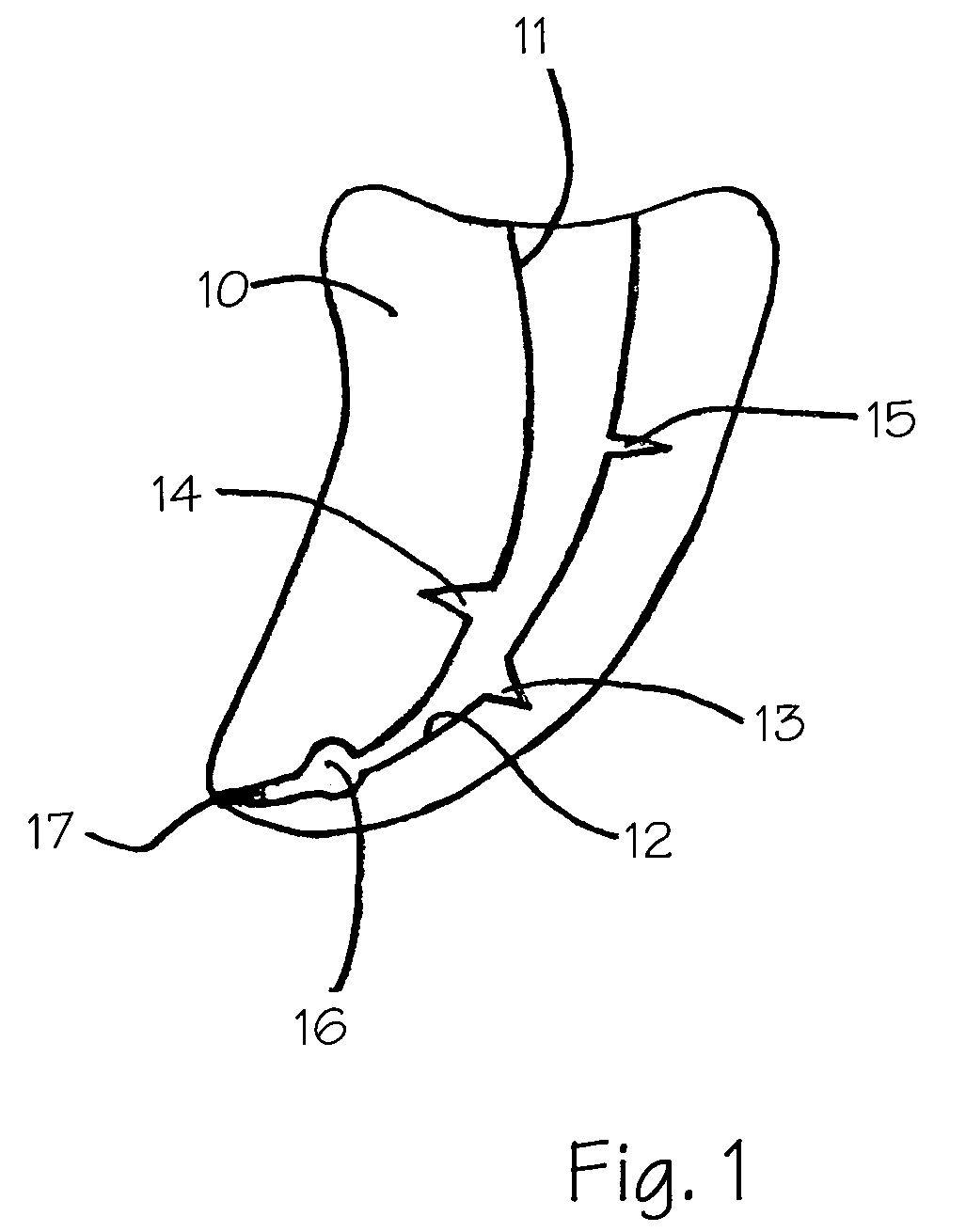 Endodontic obturator